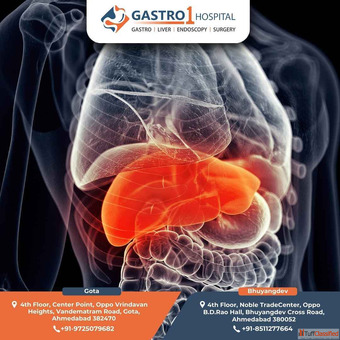 Fibroscan Liver Test Experts - Gastro1 Hospital Ahmedabad Fibroscan Liver Test Experts - Gastro1 Hospital Ahmedabad