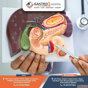 Best Gallbladder Stone Treatment in Ahmedabad - Specialist Care Best Gallbladder Stone Treatment in Ahmedabad - Specialist Care