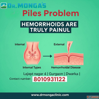 Piles Specialist Doctor in Delhi 8010931122 Piles Specialist Doctor in Delhi 8010931122