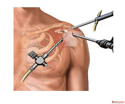 Dr.chakradhar Orthopedic Clinic in Miyapur and Madinaguda Hyderabad Dr.chakradhar Orthopedic Clinic in Miyapur and Madinaguda Hyderabad