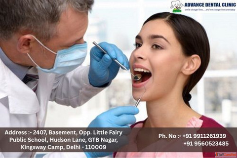 Comfortable Quick Painless Tooth Removal in GTB Nagar - Advance Dental Clinic Comfortable Quick Painless Tooth Removal in GTB Nagar - Advance Dental Clinic