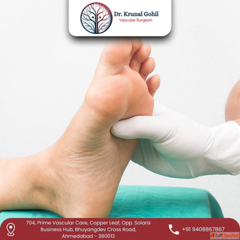 Safe Effective Gangrene Treatment in Ahmedabad India - Dr. Krunal Gohil Safe Effective Gangrene Treatment in Ahmedabad India - Dr. Krunal Gohil