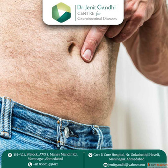Effective Hernia Treatment with the Best Surgeon in Ahmedabad India Effective Hernia Treatment with the Best Surgeon in Ahmedabad India