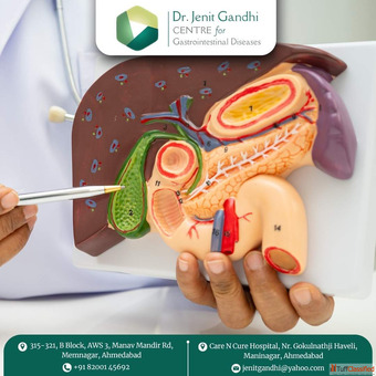 Best Gallbladder Surgeon in Ahmedabad India with Personalized Care Best Gallbladder Surgeon in Ahmedabad India with Personalized Care