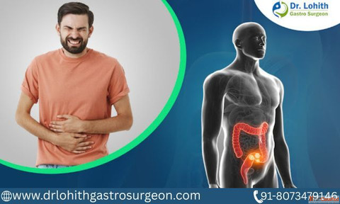 Best Gastrointestinal Oncology Surgery in Sarjapur Road by Dr. Lohith U Best Gastrointestinal Oncology Surgery in Sarjapur Road by Dr. Lohith U