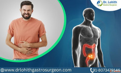 Best Gastrointestinal Oncology Surgery in Sarjapur Road by D...