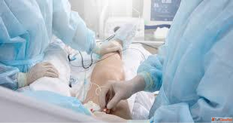 Best Hospital for Varicose Vein Treatment in India - Advanced Care for Healthy Legs Best Hospital for Varicose Vein Treatment in India - Advanced Care for Healthy Legs