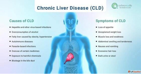 Stem Cell Therapy For Liver Damage
