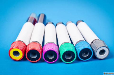 HighQuality Serum Separator Tubes for Accurate Medical Testing