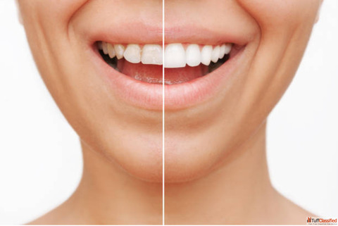 Best dental clinic in Coimbatore