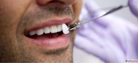 Best dental clinic in Coimbatore