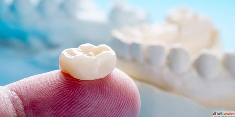 Best dental clinic in Coimbatore