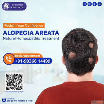Hair fall Homeopathy Treatments in Bangalore Rich Care