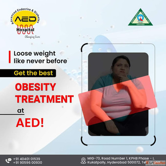 Obesity Treatment in Kukatpally Hyderabad