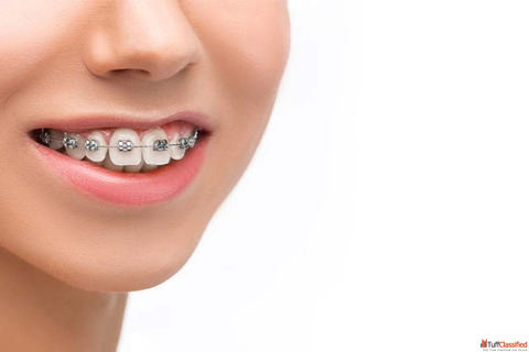 Best Dentist in Abu Dhabi