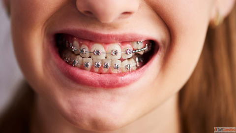Best Dentist in Abu Dhabi
