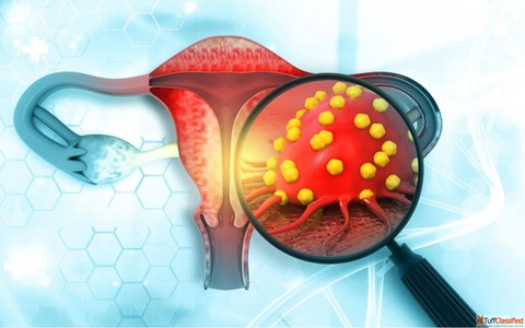Trusted Uterine Cancer Specialist in Ahmedabad