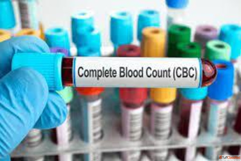 What is CBC Test