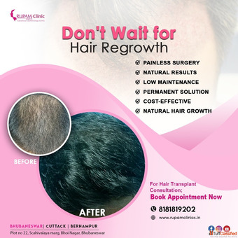 Regain Your Confidence with FUE Hair Transplant Solutions at Rupam Clinic Odisha