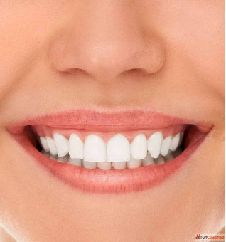 dentist in mohali 3b2