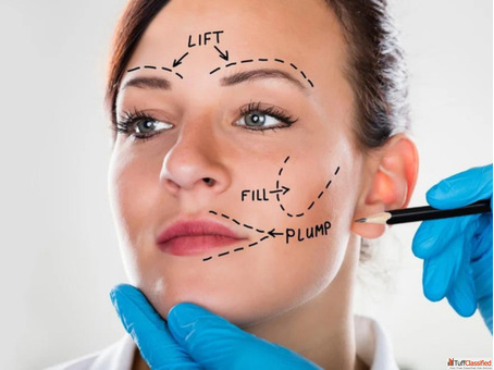 Face Lift Treatment in Lucknow