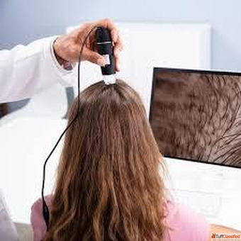 PRP Hair Treatment in Ahmedabad Gujarat Dr Krupa