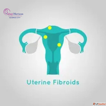 Recovery and Aftercare Tips After Uterine Fibroid Surgery