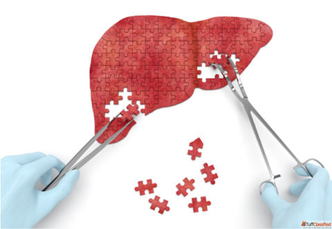 Liver cancer treatment