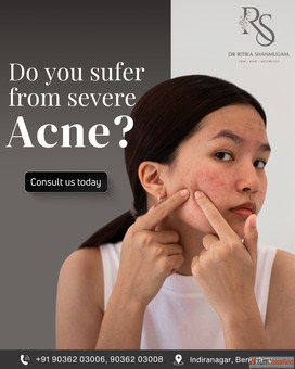 microdermabrasion laser hair removal and more."
