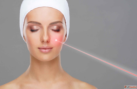 Laser Treatment in Lucknow - Amber Cosmetology