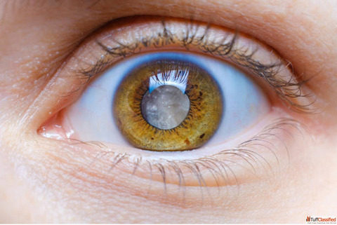 Best Clinic for Glaucoma Treatment in Mumbai