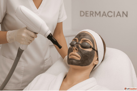 Carbon Laser Facial Benefits How It Works Side Effects in Jaipur - Dermacian Clinic