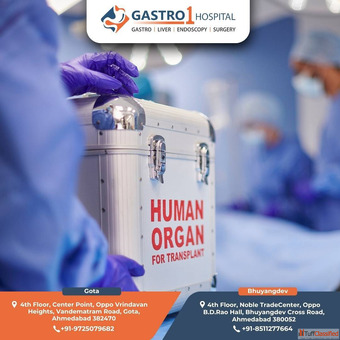 Liver Transplant in Ahmedabad - Start with the Right Consultation