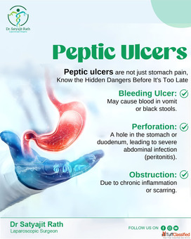 Peptic ulcer best laparoscopic surgeon in Bhubaneswar Dr Satyajit Rath