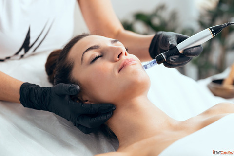 Best Microneedling in Kingston Ontario