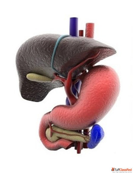 "Gallstones and Bile Duct Stones Specialist - Quick Relief Surgery Options"