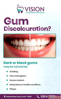 Say Goodbye to Dark or Black Gums at Vision Dental Guntur