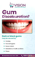 Say Goodbye to Dark or Black Gums at Vision Dental Guntur