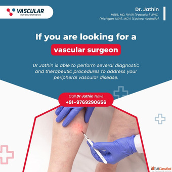 Effective Varicose Vein Treatments by a Trusted Specialist