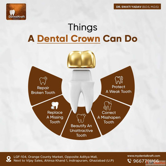Best Dental Clinic for Tooth Cap in Indirapuram