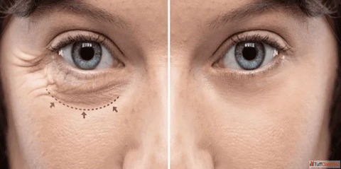Expert Oculoplasty Care in Mumbai - Eyelid Tear Duct Orbital Surgery