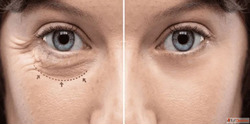 Expert Oculoplasty Care in Mumbai - Eyelid Tear Duct Orbital...