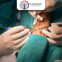 Gujarat's Best AV Fistula Surgeon Is Here to Help