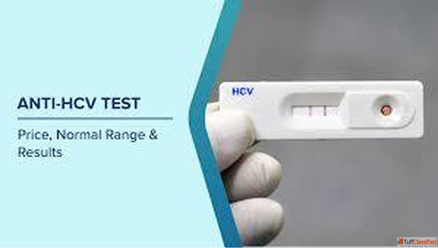 Get Swift and Reliable Test Results for Hepatitis C Virus with Max Lab