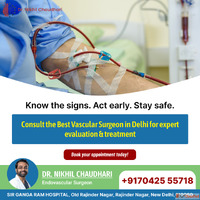Dr. Nikhil Chaudhari Best Deep Vein Thrombosis Treatment In ...