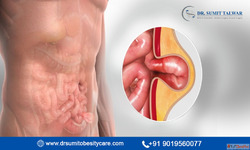 Best Doctor for Complex Abdominal Hernia Surgery in Bangalor...