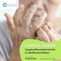 Stem cell therapy Targeting Rheumatoid Arthritis in a Multif...