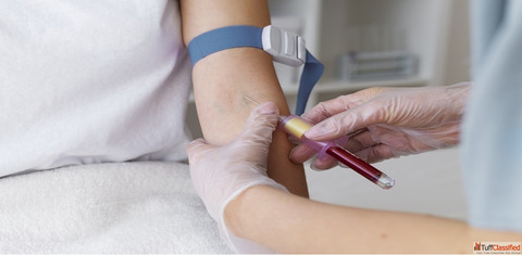 Book Malaria Test at the Best Price - Max Lab