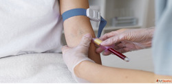 Book Malaria Test at the Best Price - Max Lab