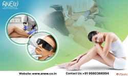 Smooth Skin with Laser Hair Removal at Anew Bangalore